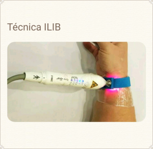 Técnica ILIB