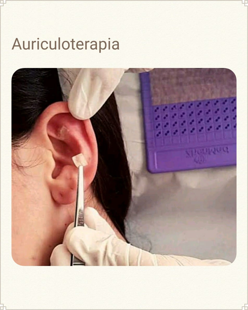 Auriculoterapia