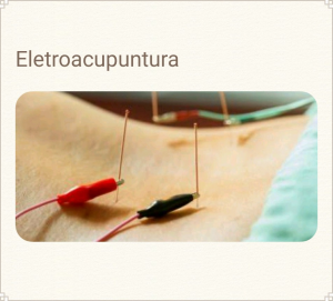 ELETROACUPUNTURA